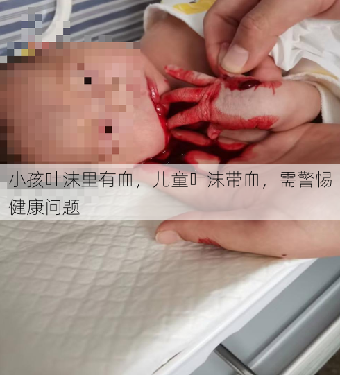 小孩吐沫里有血