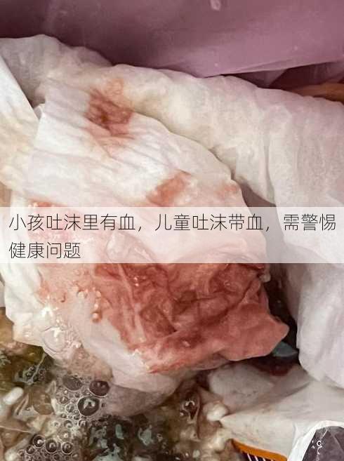 小孩吐沫里有血