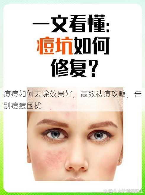 痘痘如何去除效果好