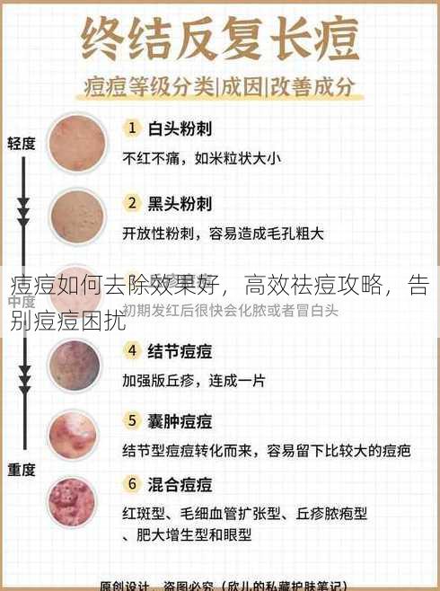 痘痘如何去除效果好