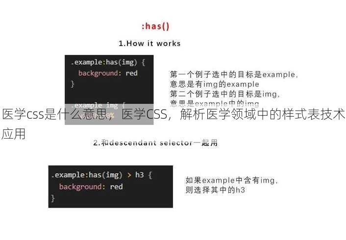 医学css是什么意思