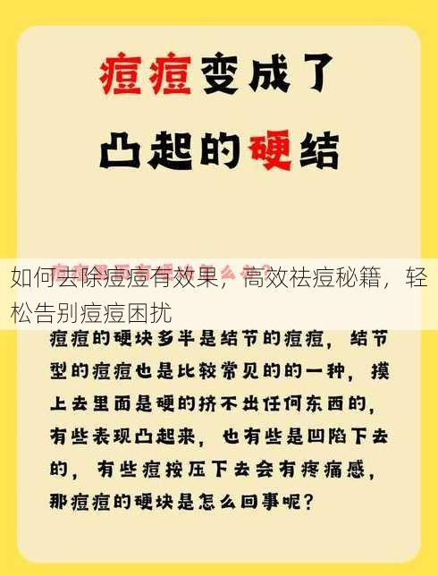 如何去除痘痘有效果
